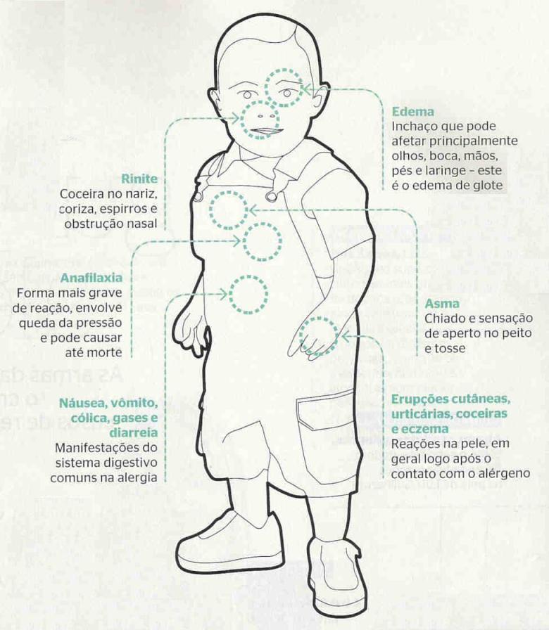 Alergia-bebe-1a